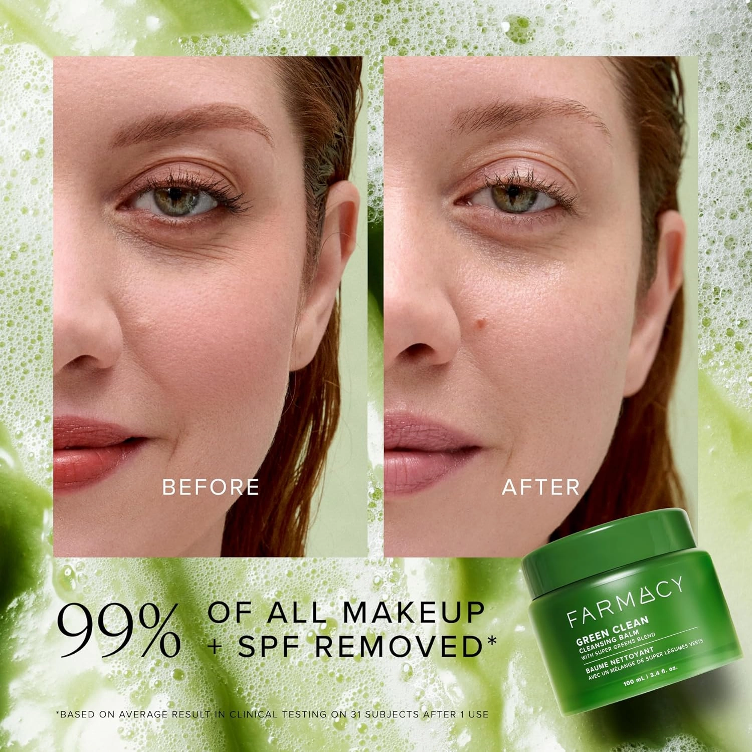 Farmacy Makeup Remover Cleansing Balm - Green Clean Waterproof Makeup Remover   Oil Based Cleanser - Newly Formulated Double Cleanser with Plant Based Waxes   Upcycled Moringa (200ml)