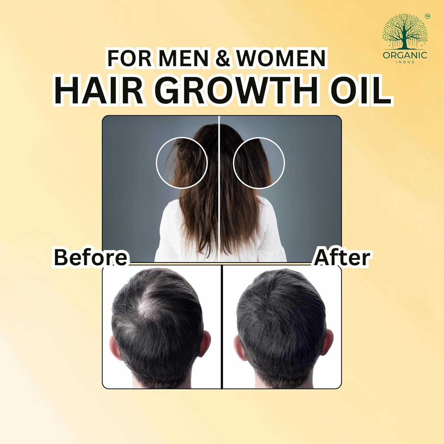 Lavender Hair Oil 8oz / 237ml | Infused with Castor Oil for Strengthen and Nourish Hair Follicles | Dry Scalp, Split Ends | Double Growth and Volumizing Formula