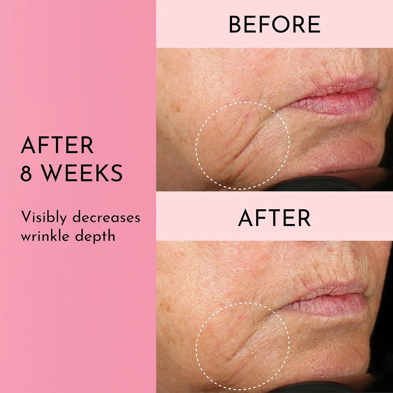 Mini Forget the Filler Skin-Plumping Line-Smoothing Perfecting Cream - Premium Non-Acne Moisturizer Designed to Prime, Plump, Smooth, and Tighten Skin for a Youthful, Hydrating Look - 0.05 oz